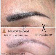 Nonoremoval Phibrows